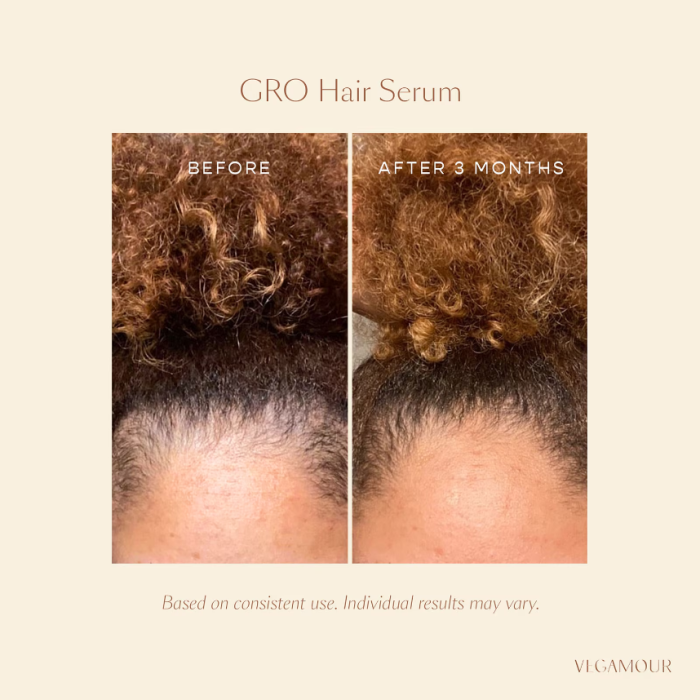 Vegamour GRO Hair Serum Trio for Thinning Hair - Image 3